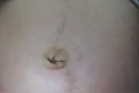 怀孕肚脐突出是男孩，这种说法靠谱吗？图片