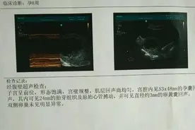 孕初期B超回来，孕妈们应该多相信宝宝很坚强！正能量~图片