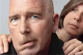 为什么有人睡觉的时候还睁着眼睛，怎么回事，能睡着吗？图片