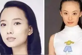 发际线越来越高，担心变秃顶！有这几样东西就不怕！图片