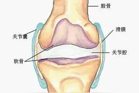 踢完球膝盖痛？你有可能是滑膜炎图片