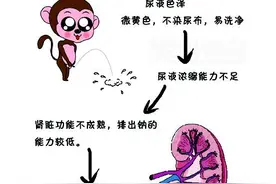 新生儿血液与泌尿特点图片