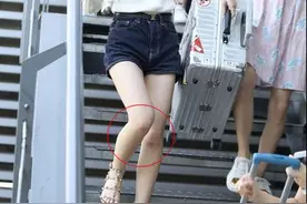 鞠婧祎机场未修近照，这次没坐行李箱 网友：膝盖的伤咋回事图片