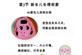 宝宝皮肤红斑，到底是怎么一回事呢？图片