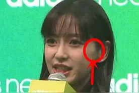 baby又偷偷换脸？面部一大包，疑似整容后遗症！图片