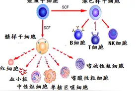 白血病及其预防图片