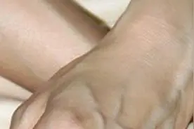 这些部位青筋凸显，告诉你可能患有11种病!图片