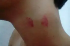 17岁少年竟被女友吻死有这个习惯的人千万当心！图片