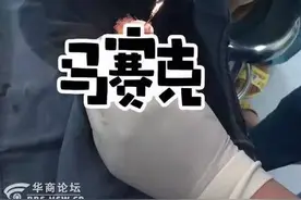 最陕西|10岁男孩尿道里塞缝衣针 取出时已生锈图片