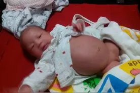 婴幼儿肚子咕咕叫， 肚子痛的危害 30年老中医这么说。。。图片