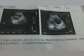 怀孕七周半，孕酮才9.未见胎心胎芽，是不是已经没希望了图片