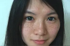 香蕉放“一物”只需3天，高效祛斑除皱秀美肌图片