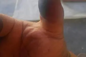 我这手怎么这么黑呢，而且还洗不干净，怎么办？图片