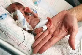 现实版拇指姑娘   世界最轻婴儿图片