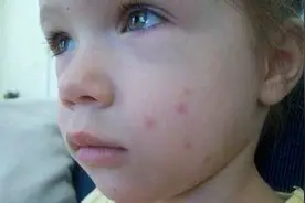 七八月份蚊虫叮咬最厉害，远离蚊虫，教你防治蚊虫小妙招图片