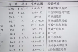 解读血常规（血小板）图片