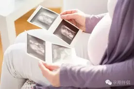 关于“唐筛”准妈妈最关心的那些问题，专家帮你全解答！图片