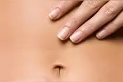 她为什么埋怨医生抠了她的肚脐？图片