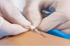 苦练穿刺神技，只为守护患者健康图片