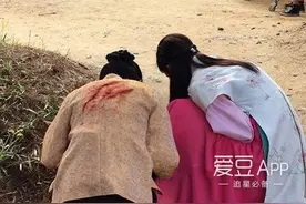 [IU][分享]160907 彩铃秦基周ins更新：解树给我涂药图片
