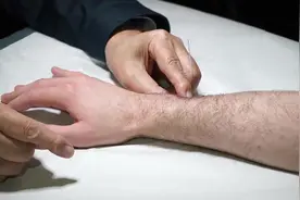中医大师展示千年针灸绝技，外国人体验后直呼“太神奇了”！视频封面