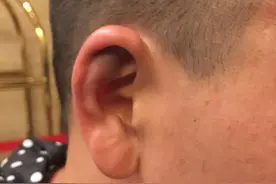 中国街球王吴悠云南打球遭群殴住院 打人者事先有预谋图片