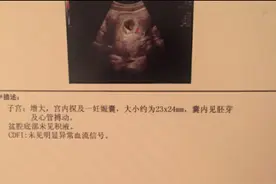 15个月怀孕3次 胎停2次终于迎来胎心胎芽图片