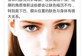 你知道肤色不均是怎么回事吗 该怎么办改善呢图片