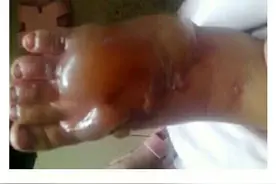 孩子发烧，我求婆婆带她去医院，婆婆说她电瓶车快没电了图片