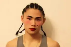 街球王 吴悠昆明遭数人群殴，微博透露后脑疼痛，并伴有耳鸣图片