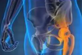 髋关节置换术三维动态演示