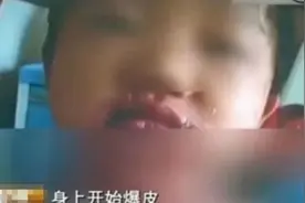 三无泡泡水危害校园，致女童全身溃烂，这种玩具不能买了