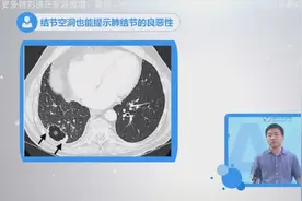 肺结节的空洞也能提示结节的良恶性视频封面