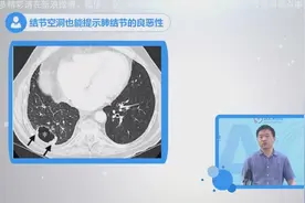 肺结节的空洞也能提示结节的良恶性视频封面