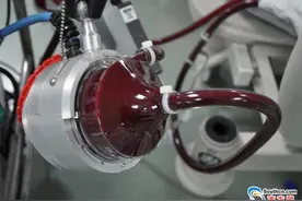 16岁男孩课上心跳呼吸骤停 “人工心肺替代”救其一命图片