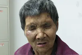 汉中寻亲：七旬老太被救助，双目失明，穿紫色外套、蓝色牛仔裤图片