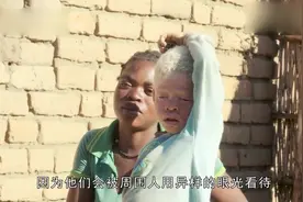 地球上最“值钱”的人，血液比黄金还贵，警察全天守候！视频封面