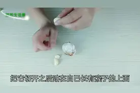 身上长出难看的小瘊子，教你用大蒜祛除法，让瘊子自然脱落