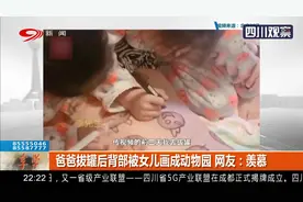 超有爱！爸爸拔罐后背部被女儿画成动物园，网友：羨慕视频封面