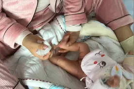 宝爸宝妈教大家如何护理新生儿臀部发红，脱皮，视频封面