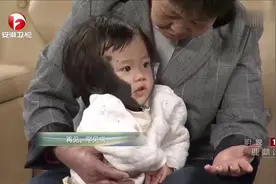 小女孩不幸患巨大型黑毛痣，面对罕见病，我们要去多了解！视频封面