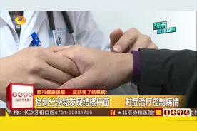 皮肤也会的结核病？男子四肢皮肤红肿破溃，误当过敏加重病情视频封面