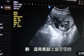 孕16周的B超，医生连宝宝的脚趾都数了一下，超细心