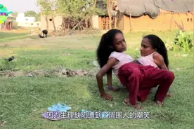 下肢共用的连体姐妹，同嫁一名男子后，怀孕了该怎么办？视频封面