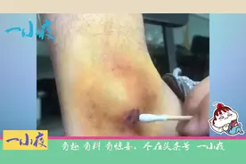 为了出军训请假教程，模特也是拼了…没错，42码鞋 长腿毛的那种