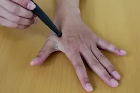 便秘口臭，该清清大肠湿热了，每天1穴，泻肠火清湿热，大肠健康视频封面