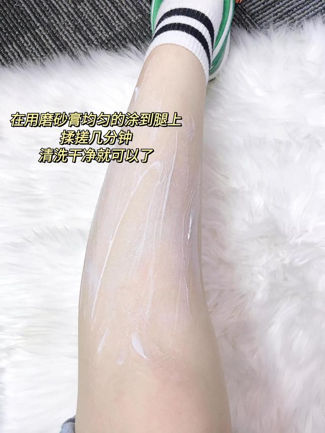 尿素霜能去鸡皮疙瘩吗