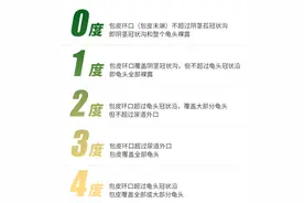 割包皮的3大误区，专家说：不清楚这几点，小心白割图片