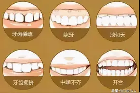 牙齿松动怎么办？难道只能等着它掉落了？图片