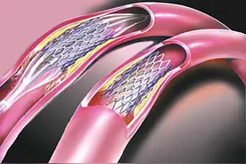 钟南山心脏支架手术15年，84岁都没有再堵，离不开这四个习惯图片